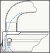 recovery system